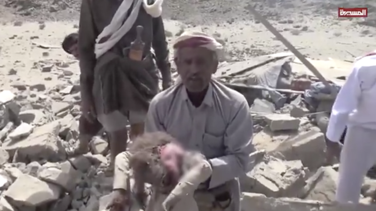 Saudi Attacks in Yemen Have Killed 155 Civilians Since July: Health Ministry
